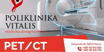 Otključajte tajne PET/CT dijagnostike u Mostaru: Kako bez čekanja do preciznih nalaza