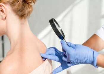 SKB: Besplatni dermatološki pregledi u sklopu kampanje Euromelanoma u Mostaru