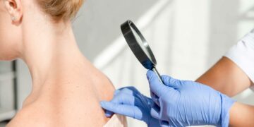 SKB: Besplatni dermatološki pregledi u sklopu kampanje Euromelanoma u Mostaru