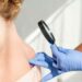 SKB: Besplatni dermatološki pregledi u sklopu kampanje Euromelanoma u Mostaru