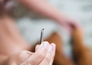 Što uraditi nakon ujeda krpelja i kada se javiti doktoru?
